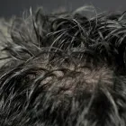 Entreprises 1 image 3RD DIMENSION STUDIOS HD HAIR SYSTEMS Health & Medicine dans North York ON