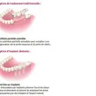 Business 1 image A CLINIQUE DENTUROLOGIE DIANE VOLGO D D Health & Medicine in Laval QC