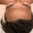 Entreprises 1 image ADAPT ACUPUNCTURE AND PERFORMANCE Acupuncturists & Acupuncture Clinics dans Etobicoke ON