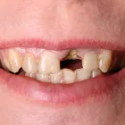 Business 3 image AMIRAD FAMILY DENTISTRY Cosmetic Dentistry in Toronto ON