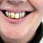 Entreprises 10 image BURNETT DENTURE CLINIC Health & Medicine dans Kelowna BC