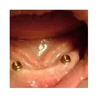 Entreprises 12 image BURNETT DENTURE CLINIC Health & Medicine dans Kelowna BC