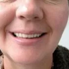 Entreprises 14 image BURNETT DENTURE CLINIC Health & Medicine dans Kelowna BC
