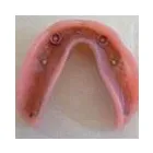 Entreprises 3 image BURNETT DENTURE CLINIC Health & Medicine dans Kelowna BC