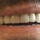 Business 6 image DAN LANDRY DENTURE CLINIC Health & Medicine in Windsor ON