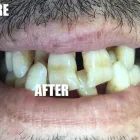 Business 3 image DAN LANDRY DENTURE CLINIC Health & Medicine in Windsor ON