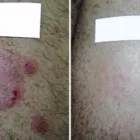 Business 4 image DERMASPARK PRODUCTS INC. Plastic & Cosmetic Surgery in Vancouver BC