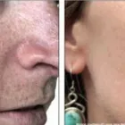 Entreprises 5 image DIVINE SECRETS BEAUTY CLINIC Skin Care Clinics & Services dans Mississauga ON