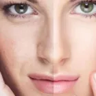 Entreprises 2 image DIVINE SECRETS BEAUTY CLINIC Skin Care Clinics & Services dans Mississauga ON