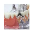 Entreprises 3 image GAGNON GAÉTAN DENTUROLOGISTE Health & Medicine dans Pointe-aux-trembles QC