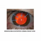 Entreprises 4 image HAMPTON PARK OPTOMETRY Ophthalmologists, Optometrists & Opticians dans Ottawa ON
