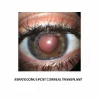 Entreprises 5 image HAMPTON PARK OPTOMETRY Ophthalmologists, Optometrists & Opticians dans Ottawa ON