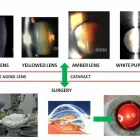 Entreprises 7 image HAMPTON PARK OPTOMETRY Ophthalmologists, Optometrists & Opticians dans Ottawa ON