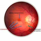 Entreprises 1 image HAMPTON PARK OPTOMETRY Ophthalmologists, Optometrists & Opticians dans Ottawa ON