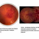 Entreprises 2 image HAMPTON PARK OPTOMETRY Ophthalmologists, Optometrists & Opticians dans Ottawa ON