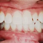 Entreprises 6 image HERITAGE VILLAGE DENTAL CLINIC Health & Medicine dans Edmonton AB