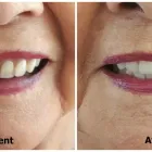 Entreprises 4 image KELOWNA DENTURE CLINIC Health & Medicine dans Kelowna BC