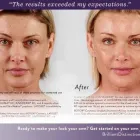 Business 3 image LAKESHORE VEIN & AESTHETICS CLINIC INC Health & Medicine in Kelowna BC
