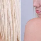 Entreprises 4 image LUCERE DERMATOLOGY & LASER CLINIC Skin Care Clinics & Services dans Edmonton AB