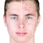 Entreprises 5 image LUCERE DERMATOLOGY & LASER CLINIC Skin Care Clinics & Services dans Edmonton AB