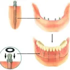 Entreprises 6 image MARCOUX DENTUROLOGISTE Health & Medicine dans Dieppe NB