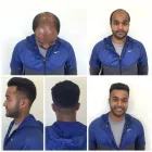 Business 16 image PACIFIC HAIR LOSS SOLUTIONS Wigs & Hairpieces in Vancouver BC