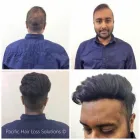 Business 18 image PACIFIC HAIR LOSS SOLUTIONS Wigs & Hairpieces in Vancouver BC