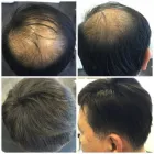 Business 20 image PACIFIC HAIR LOSS SOLUTIONS Wigs & Hairpieces in Vancouver BC