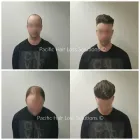 Business 23 image PACIFIC HAIR LOSS SOLUTIONS Wigs & Hairpieces in Vancouver BC