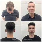 Business 32 image PACIFIC HAIR LOSS SOLUTIONS Wigs & Hairpieces in Vancouver BC