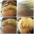 Business 35 image PACIFIC HAIR LOSS SOLUTIONS Wigs & Hairpieces in Vancouver BC