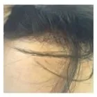 Business 38 image PACIFIC HAIR LOSS SOLUTIONS Wigs & Hairpieces in Vancouver BC