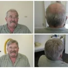 Business 8 image PACIFIC HAIR LOSS SOLUTIONS Wigs & Hairpieces in Vancouver BC