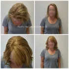 Business 9 image PACIFIC HAIR LOSS SOLUTIONS Wigs & Hairpieces in Vancouver BC