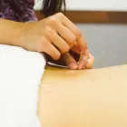 Entreprises 8 image REBALANCE SPORTS MEDICINE Physiotherapists dans Toronto ON