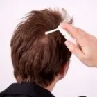 Entreprises 3 image REMPLACEMENT CAPILLAIRE MONTREAL Wigs & Hairpieces dans Dollard-des-ormeaux QC