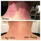 Business 1 image SACHEEN'S SKINCARE SOLUTIONS Skin Care Clinics & Services in Kelowna BC