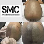 Business 10 image SCALP MICROPIGMENTATION TRAINING CENTER Health & Medicine in Toronto ON