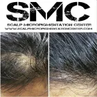 Business 14 image SCALP MICROPIGMENTATION TRAINING CENTER Health & Medicine in Toronto ON