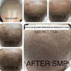 Business 18 image SCALP MICROPIGMENTATION TRAINING CENTER Health & Medicine in Toronto ON