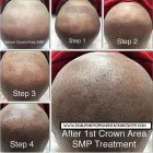 Business 2 image SCALP MICROPIGMENTATION TRAINING CENTER Health & Medicine in Toronto ON