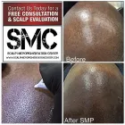 Business 22 image SCALP MICROPIGMENTATION TRAINING CENTER Health & Medicine in Toronto ON
