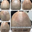 Business 23 image SCALP MICROPIGMENTATION TRAINING CENTER Health & Medicine in Toronto ON