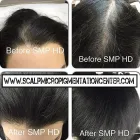 Entreprises 8 image SCALP MICROPIGMENTATION TRAINING CENTER Wigs & Hairpieces dans Toronto ON