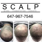 Business 26 image SCALP MICROPIGMENTATION TRAINING CENTER Health & Medicine in Toronto ON