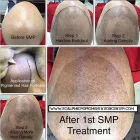 Business 27 image SCALP MICROPIGMENTATION TRAINING CENTER Health & Medicine in Toronto ON