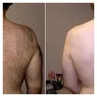 Entreprises 2 image SENSEI LASER & VEIN REJUVENATION LTD Weight Loss Centres dans West Kelowna BC