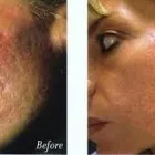 Entreprises 5 image SENSEI LASER & VEIN REJUVENATION LTD Weight Loss Centres dans West Kelowna BC