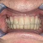 Business 1 image SHORE SIDE DENTISTRY Health & Medicine in Oakville ON