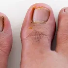 Entreprises 4 image STEP AHEAD PODIATRY CLINIC - SOUTH EDMONTON Chiropodists & Podiatrists dans Edmonton AB